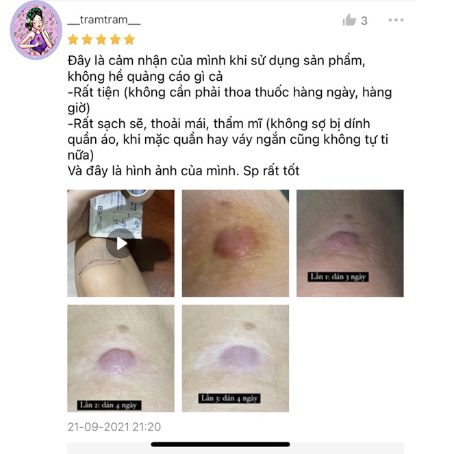 Miếng dán ép sẹo lồi ECLAR PLASTER (HISAMITSU Nhật bản)