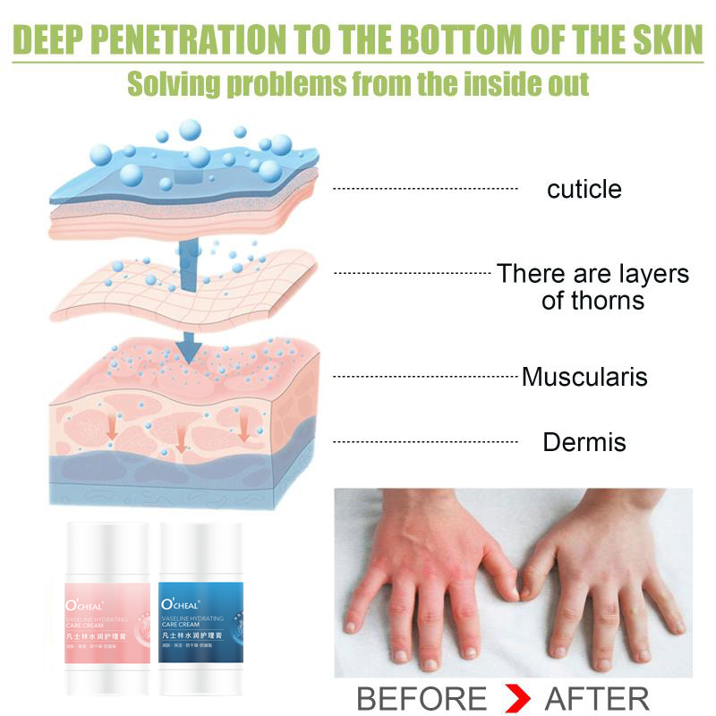 Vaseline%20Anti-Drying%20Crack%20Foot%20Cream%20Hand%20Cracked%20Repair%20Cream%20Removal%20Dead%20Anti%20Cracking%20Skin%20Hand%20Feet%20Care%20Cream%20Wholesale%20-%20Image%206