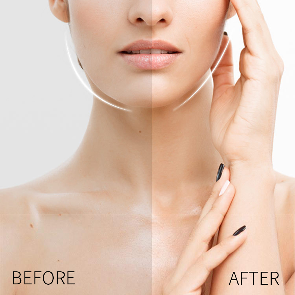 V-Shape%20Face%20Lift%20Tape%20Invisible%20Face%20Lifter%20Tape%20Breathable%20Lift%20Sticker%20Instant%20Makeup%20Lift%20Tools%20Wrinkle%20Removal%20-%20Image%205