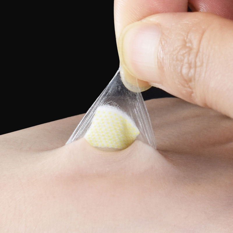 20/50/100Pcs/box%20Waterproof%20Breathable%20Round%20Band%20Aids%20Adhesive%20for%20Children%20Wound%20Care%20First%20Aid%20-%20Image%204