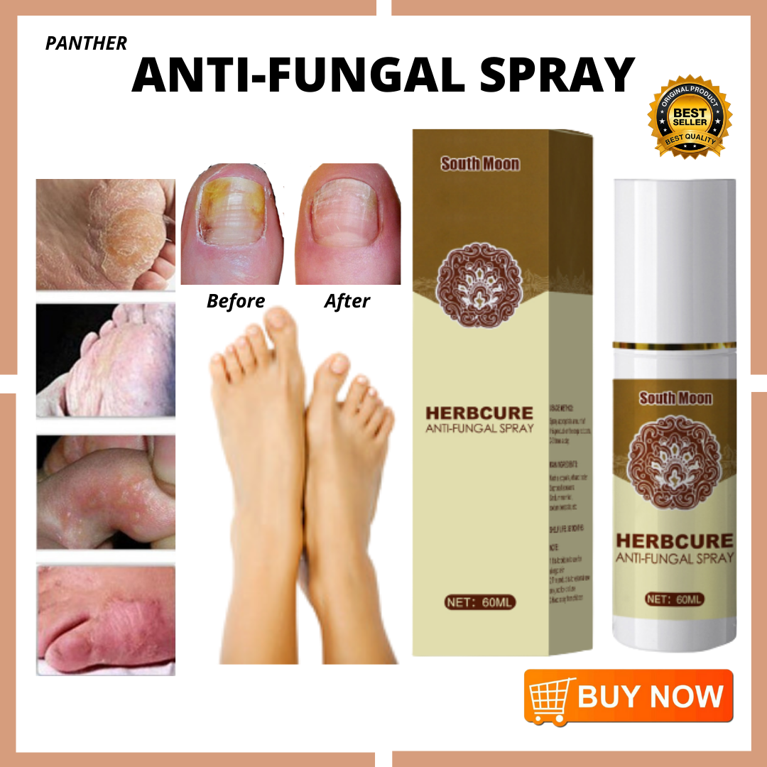 TOP SELLING Herbcure Anti-Fungal Spray Fungal Combat Feet Spray 60ml ...