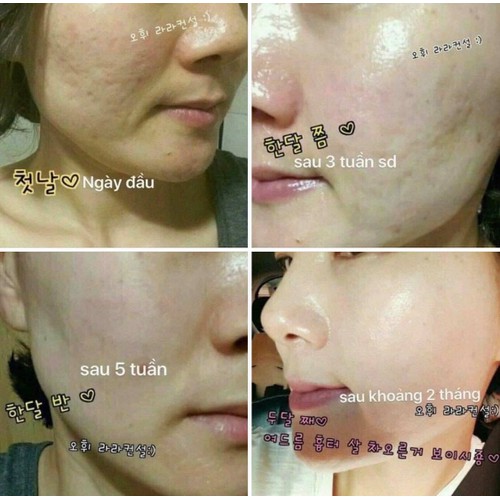 [HCM]Tinh chất Vàng 24k OHUI The First Ampoule Advanced 20ml
