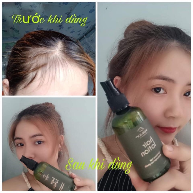 Tinh dầu xịt bưởi VIJULY ngăn rụng tóc kích mọc tóc
