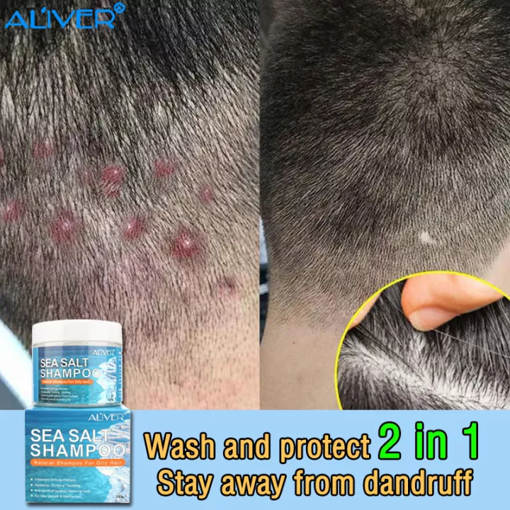 【COD】ALIVER Sea Salt Shampoo For dandruff and scalp treatment 200g