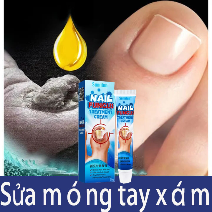 Kem dưỡng móng tay chân làm hồng, chắc khỏe móng Nail Fungus Treatment Cream 20g