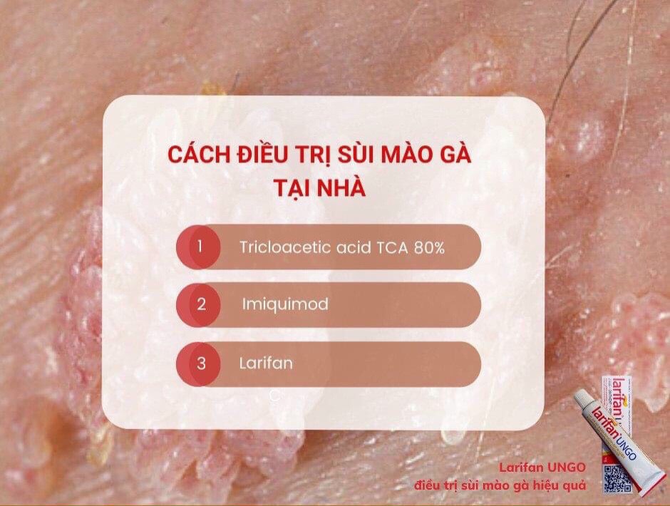 Dung dịch Test sùi mào gà