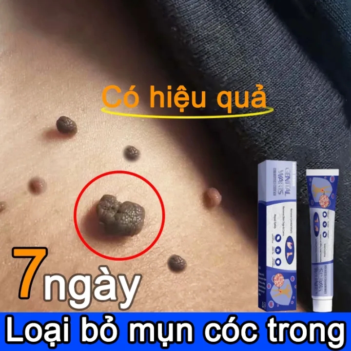 Gel tẩy nốt ruồi cam kết tẩy nốt ruồi, mụn cóc, mụn thịt, sẹo lồi gây hại cho da