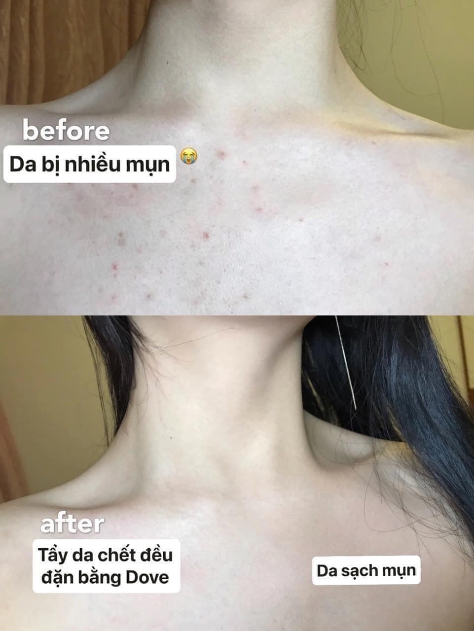 TẨY DA CHẾT DOVE - BẢN ĐỨC