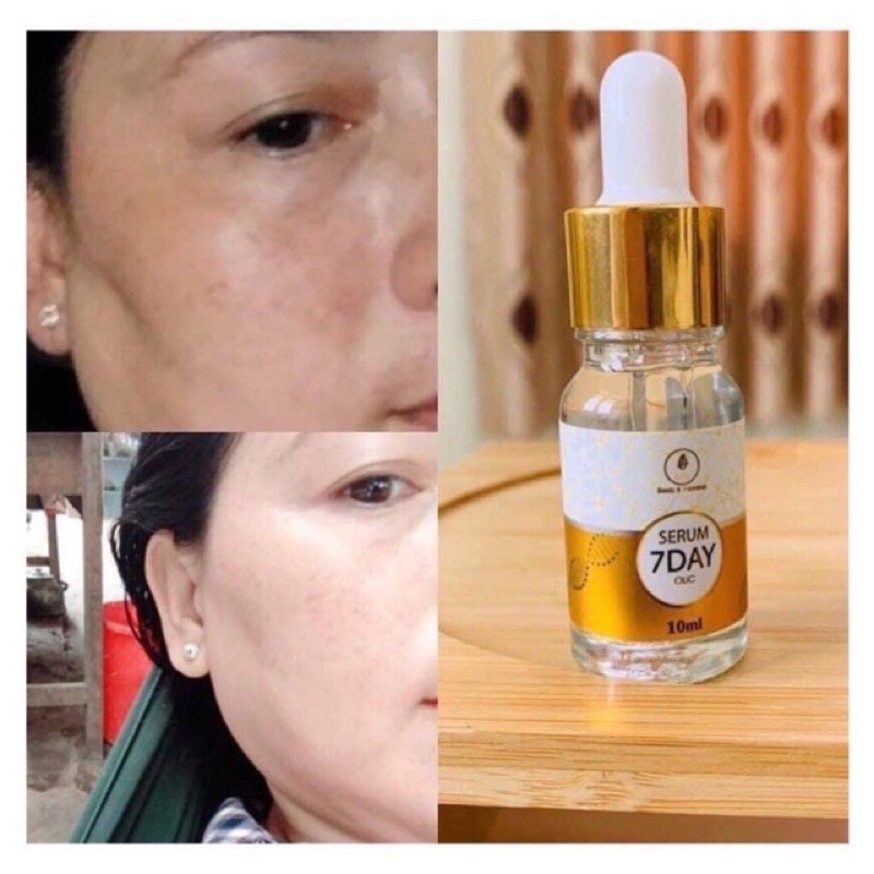Huyết thanh truyền trắng 7DAYS