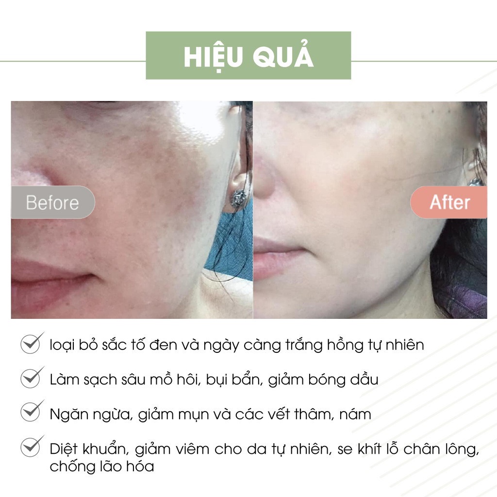 Kem Face Pháp Acosmetics Mẫu Mới [Hàng Chính Hãng]