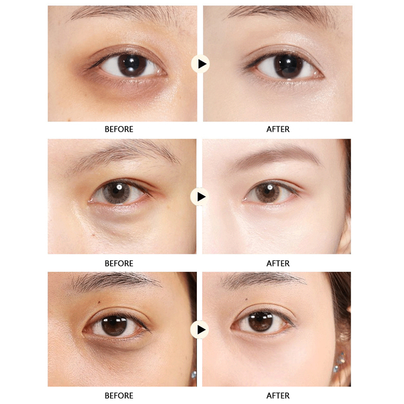 HOT%20Gold%20Collagen%20Eye%20Mask%20Eye%20Patches%20For%20Dilute%20Dark%20Circle%20Hydrating%20Eye%20Patch%20Pad%20Anti-Wrinkles%20Nourishing%20Masks%20Korea%20Cosmetics%20-%20Image%204