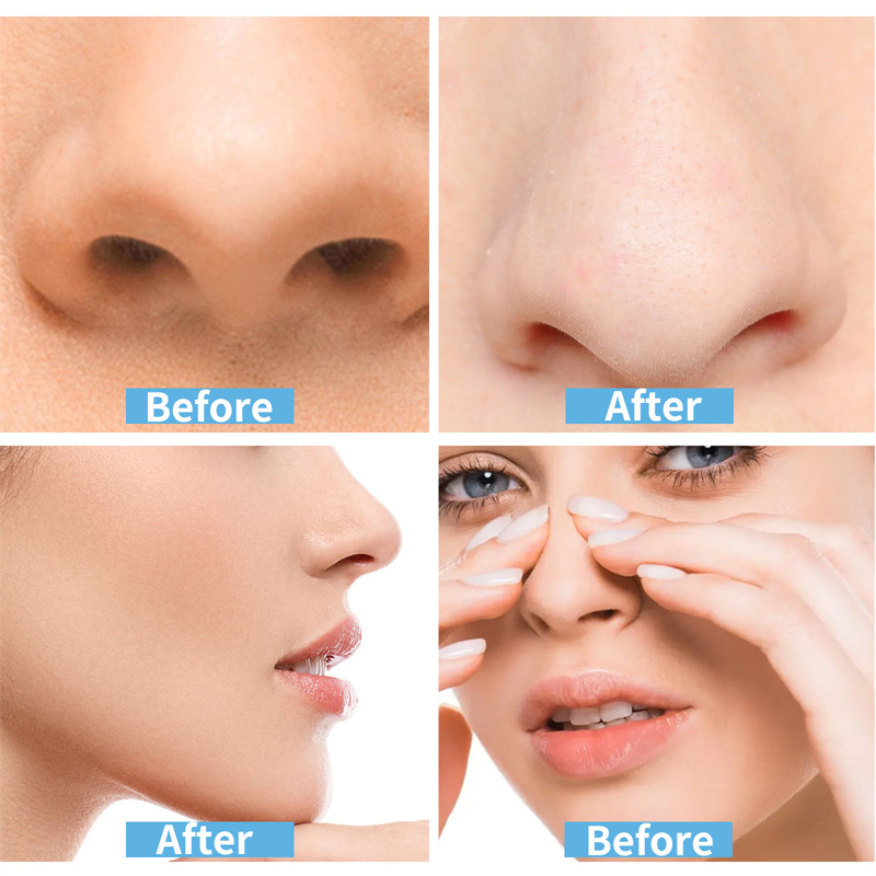 Cosplay Special Nose Shrink Strips Shrink Nose Wings Small Nose Narrow Thin Nose Invisible Beauty Shrinking Nose Wing Stickers 5a63. 