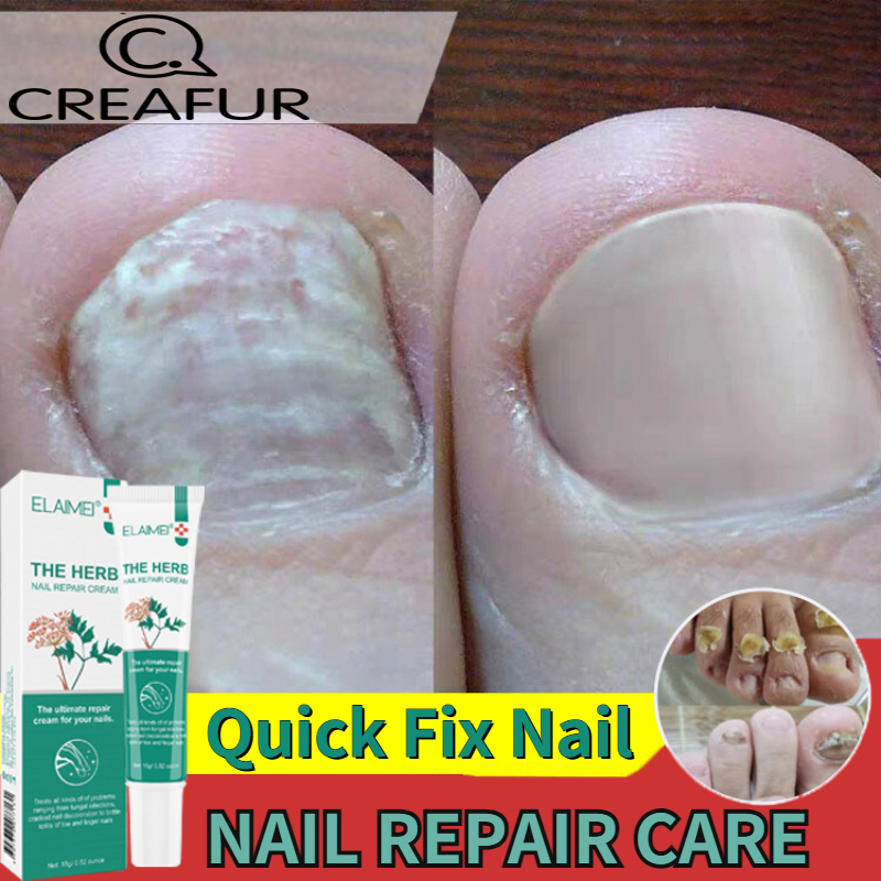 Nail Repair Cream 20g Nail fungus cream Nail Soothing Repair Cream Plant essence bright