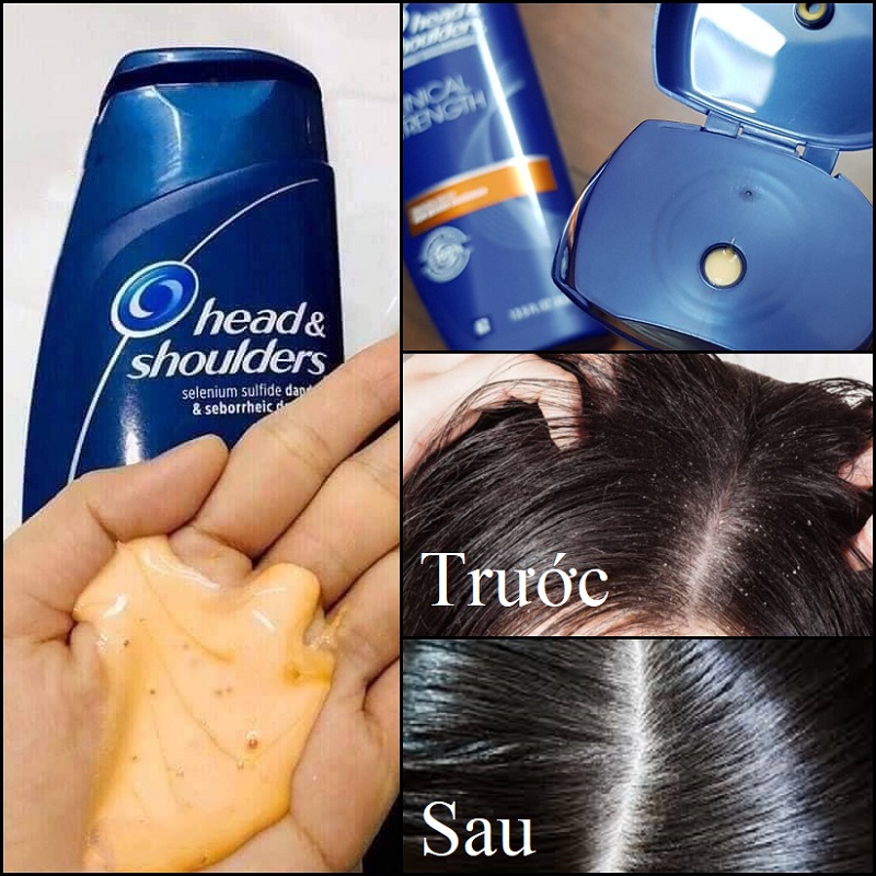 Dầu gội Head & Shoulders Clinical Strength 400ml