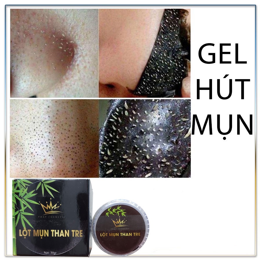 Gel Hút Mụn Than Tre Hoạt TÍnh 30 Gr