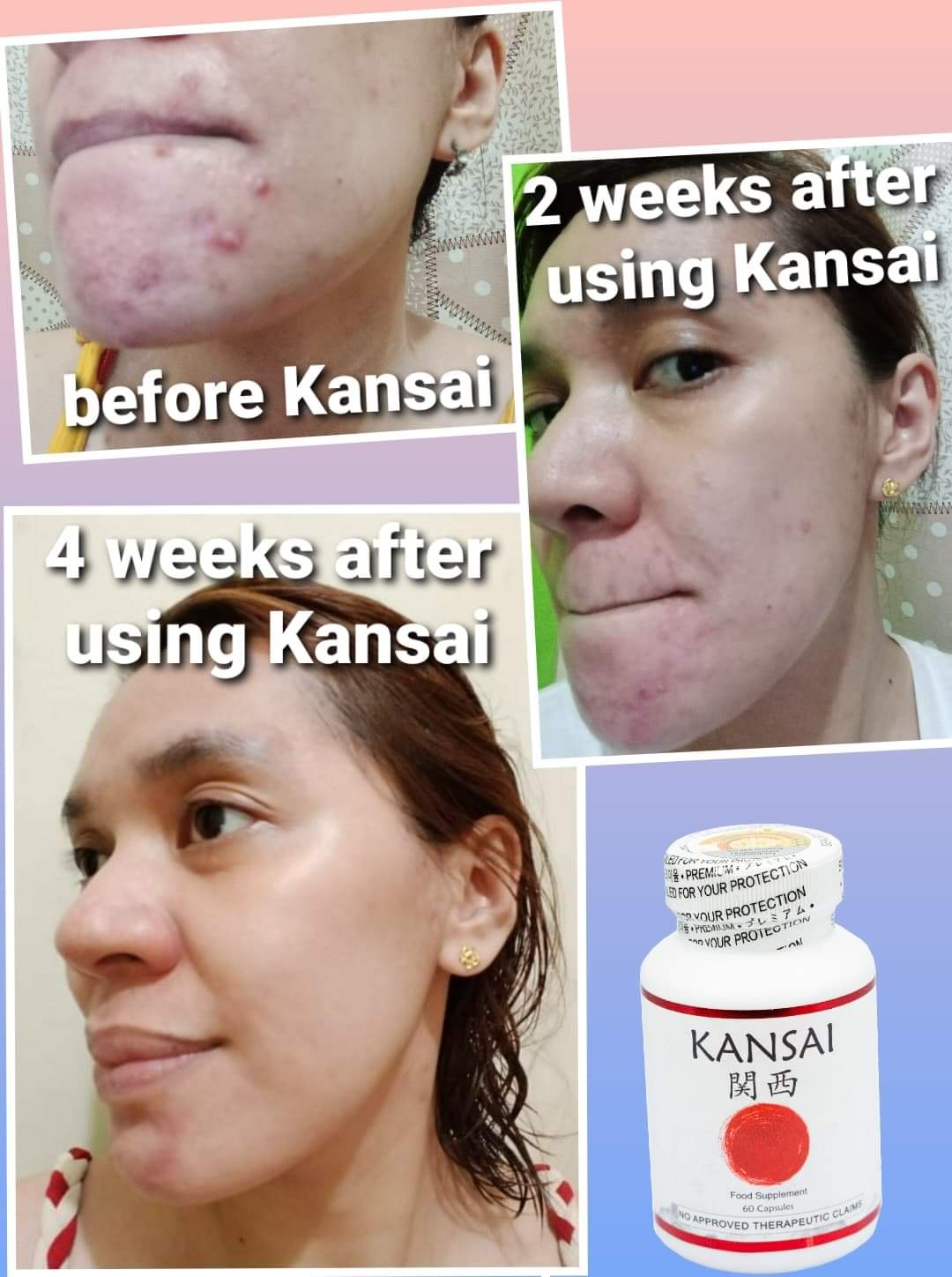 kansai glutathione ingredients Kansai Glutathione L-Glutamic Acid Glycine L-Cystine with NAC Marine  CollagenVit C Rosehips ALA Marine Collagen Antioxidants Vitamin C And Alpha  Lipoic Acid Single Item Health Formulation - Lazada
