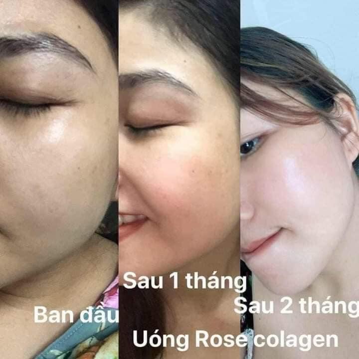 COLLAGEN YẾN TRẮNG DA ROSE BEAUTY ( phiên bảng mới trắng X10)