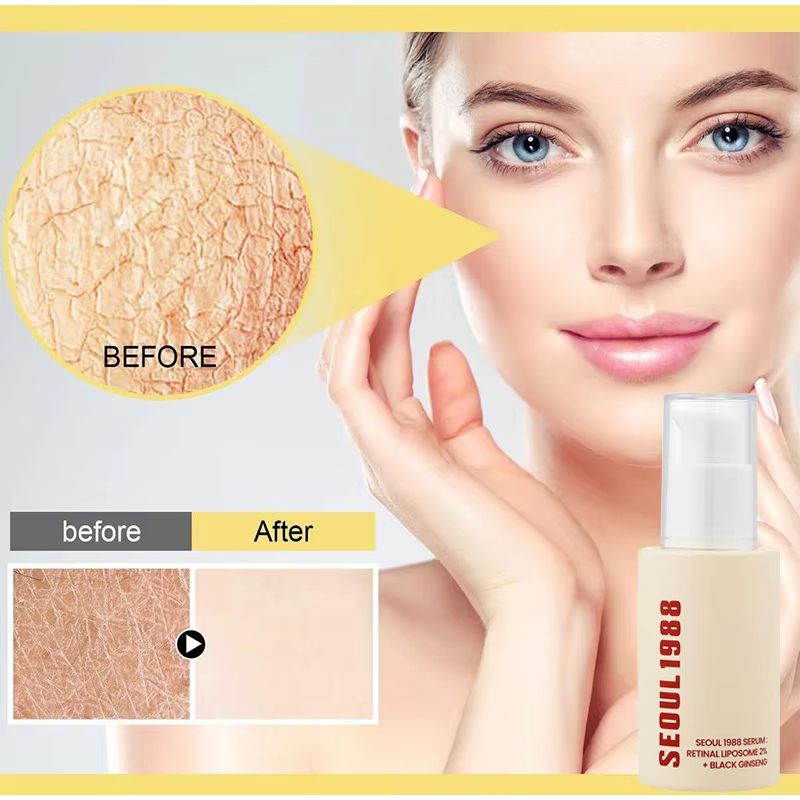 Korean%201988%20Retinol%20Face%20Care%20Serum,Black%20Ginseng%20Niacinamide%20Vitamin%20C%20Moisturizing%20Firming%20Ampoule,Anti%20Aging%20Wrinkle%20Skincare%20-%20Image%203