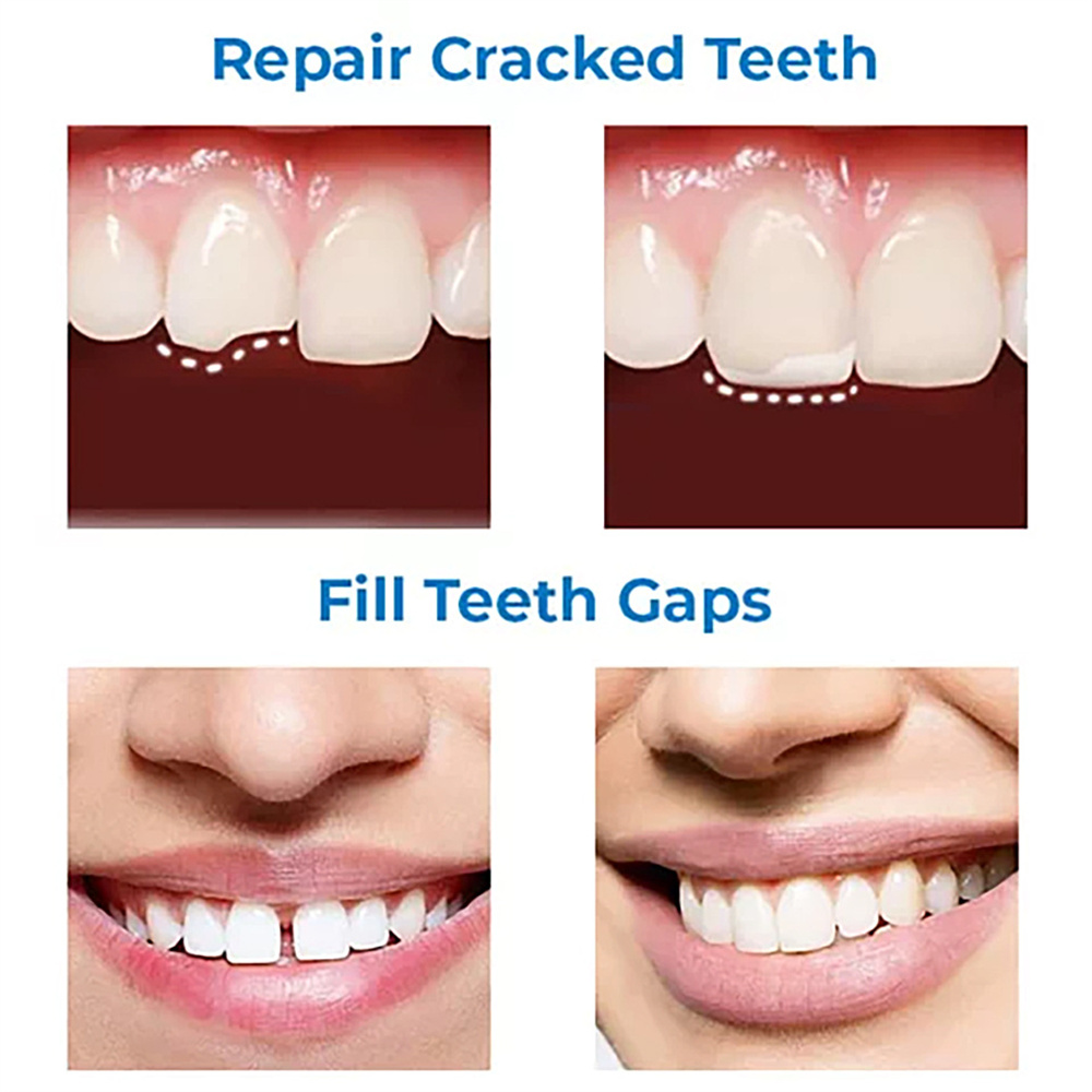 Merbox Moldable False Teeth Temporary Repair Teeth Firmly Thermal Forming Solid Gutta-percha Shapeable Teething Gum Particles Dental Care