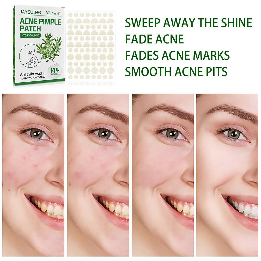 144 Pcs Waterproof Acne Pimple Patch Invisible Stickers Tea Tree Oil Acne Patch