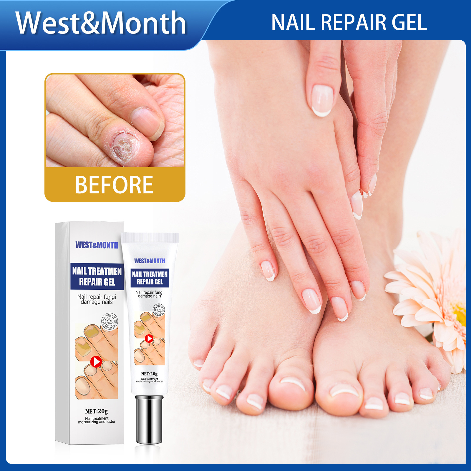 West Month Nail Treatment Repair Gel Nail Treatment Essence Fungal Nail ...