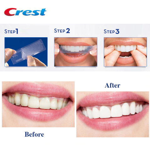 1 Miếng dán trắng răng crest 3d professional effects