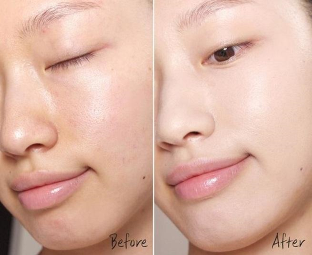 Serum cấp ẩm, phục hồi da B5 Hydr8 Medik8 60ml