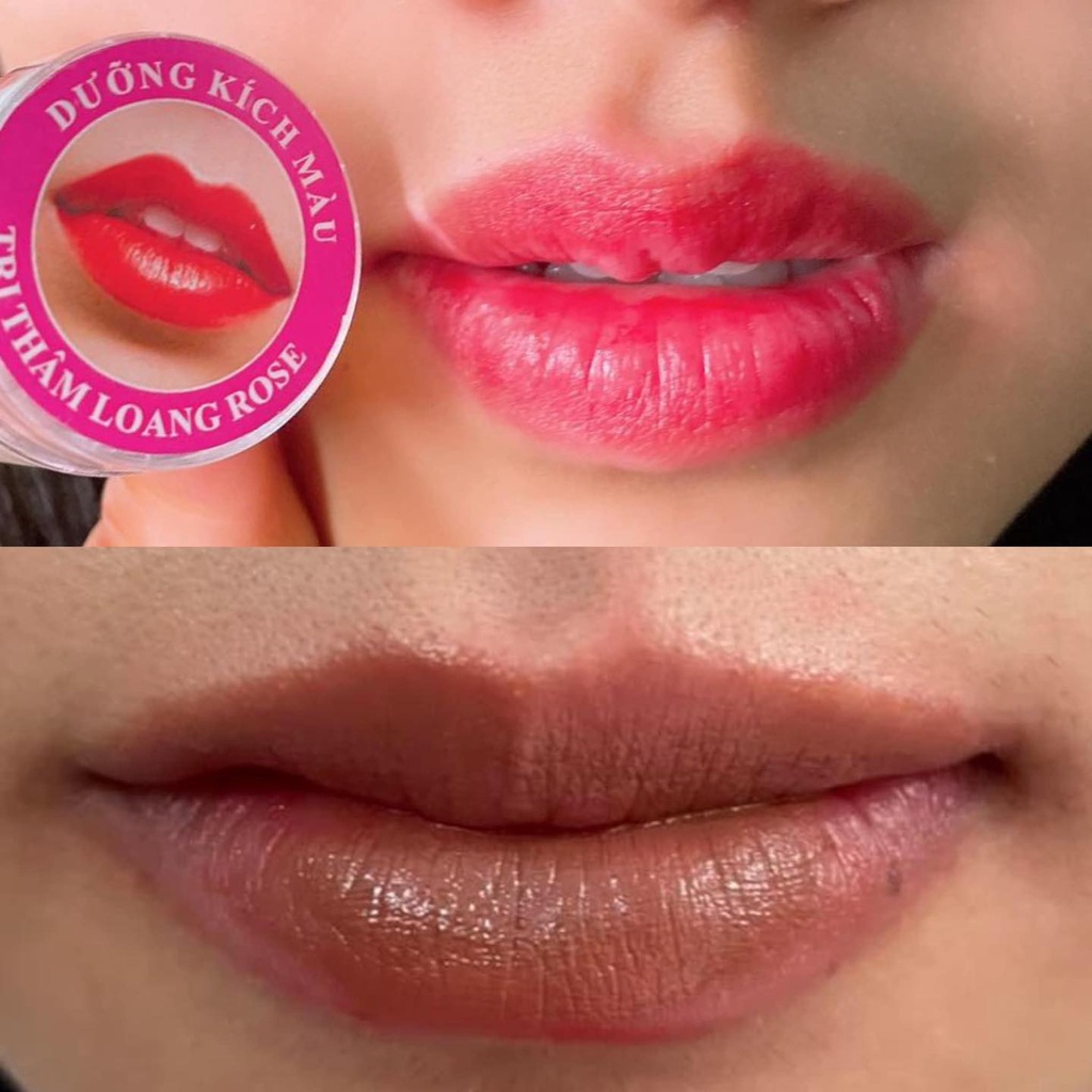 DƯỠNG KÍCH MÀU THÂM LOANG ROSE