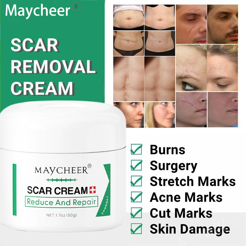 Maycheer Scar Cream Removal Krim Penghilang scar keloid bopeng bekas ...