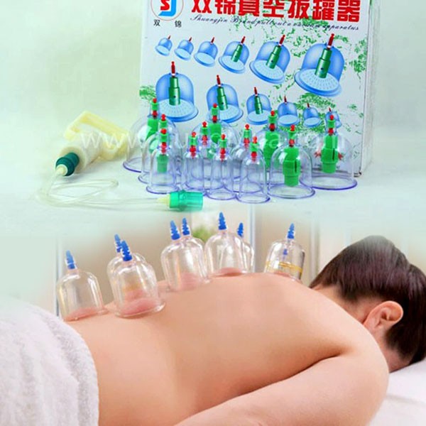 Bộ Giác Hơi Không Dùng Lửa 12 Cốc