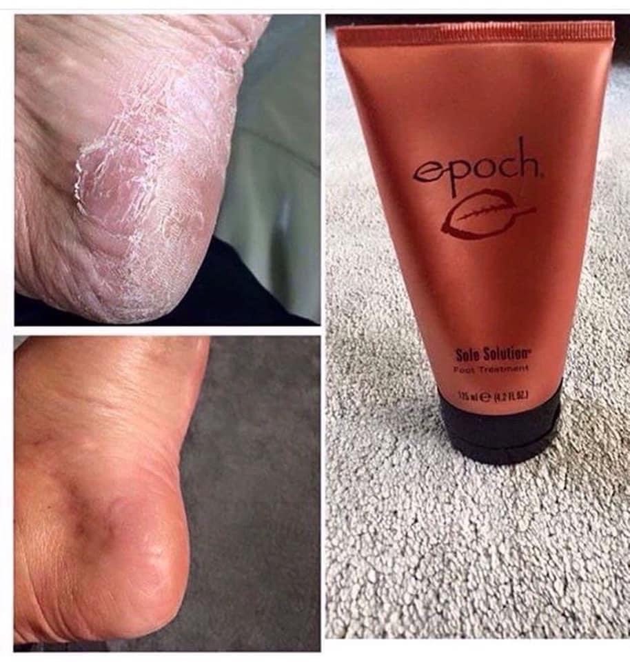 Kem Dưỡng Da Chân- EPOCH SOLE SOLUTION FOOT TREATMENT