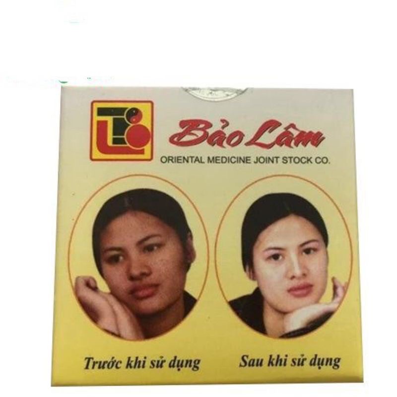 Bảo lâm kem dưỡng trắng ngừa mụn lọ 10 g