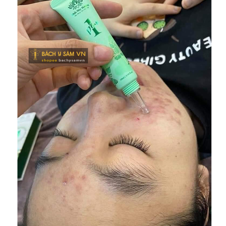 Chấm Mụn 01 Bách Y Sâm - Nhat Moc Huong