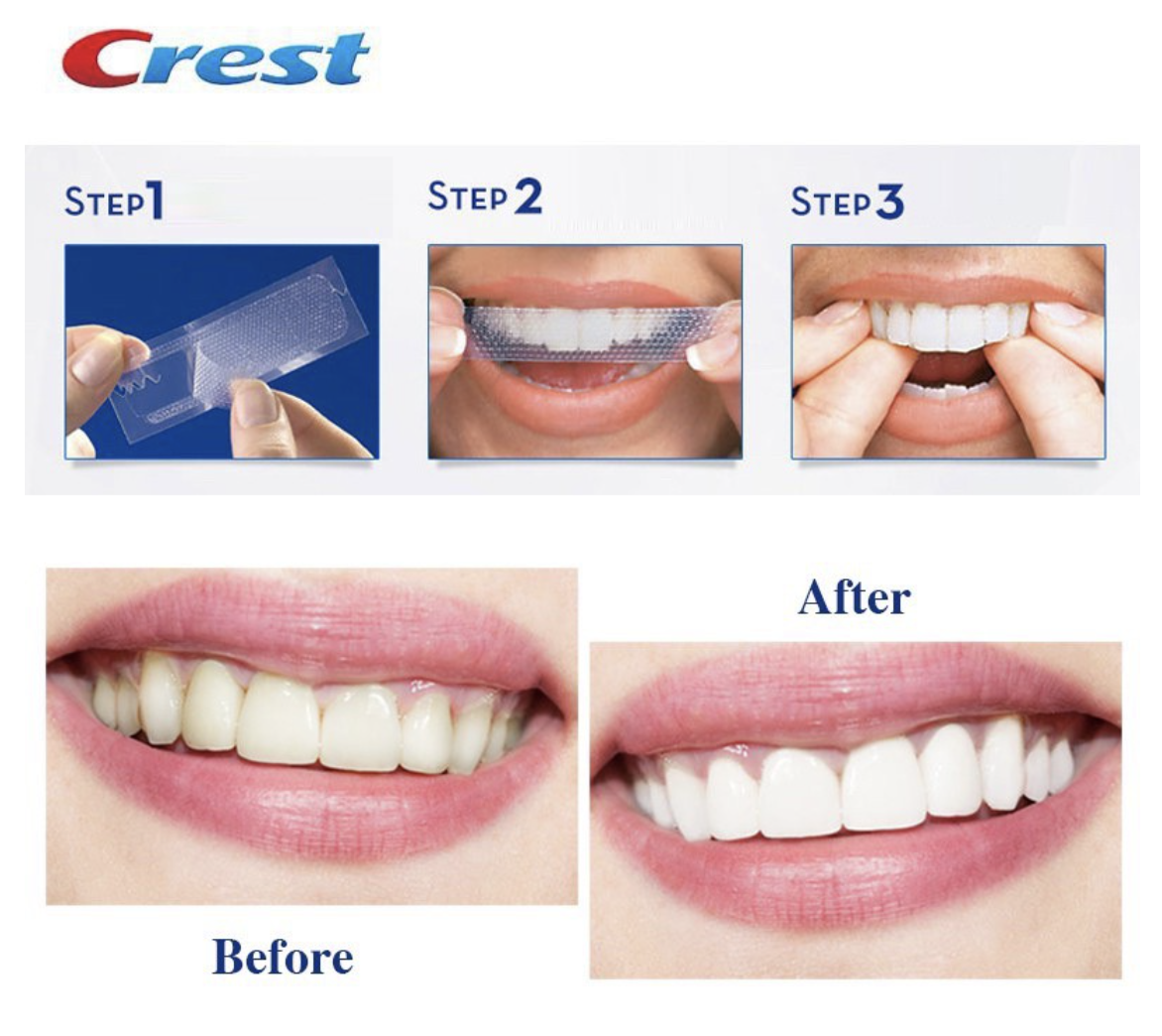 Miếng dán trắng răng Crest 3D levels 12 whiter