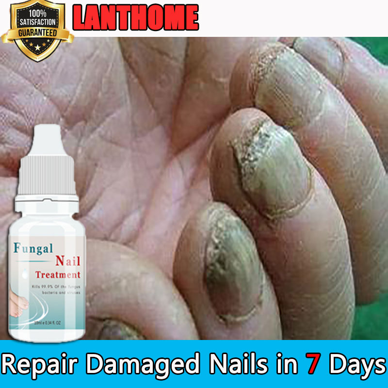 [Universal For Hands And Feet] LANTHOME Nail Care Liquid 10ml Effective