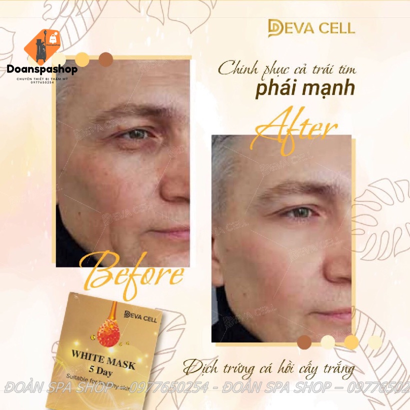 Dịch Trứng Cá Hồi Cấy Trắng DevaCell Chính Hãng Deva Cell