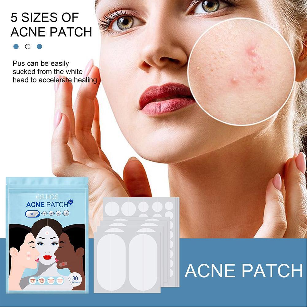 Yuanyan%2080pcs/set%20Large%20Size%20Acne%20Pimple%20Patch%20Face%20Treatment%20Invisible%20Tools%20Acne%20Remover%20Blemish%20Pimples%20Stickers%20D3T7%20-%20Image%202