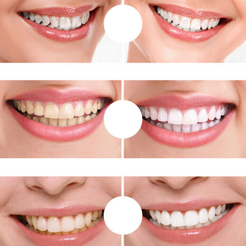 %E3%80%90Good-Love%20Store%E3%80%91Hot%20Pen%20Professional%20White%20Gel%20Whitener%20Bleach%20Remove%20Stains%20Bright%20Smile%20Teeth%20-%20Image%206