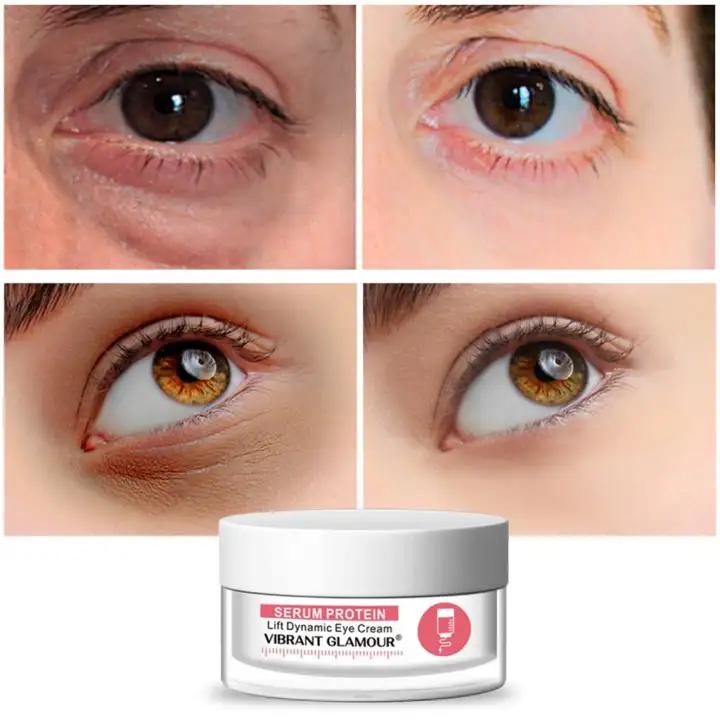 most effective anti wrinkle eye cream