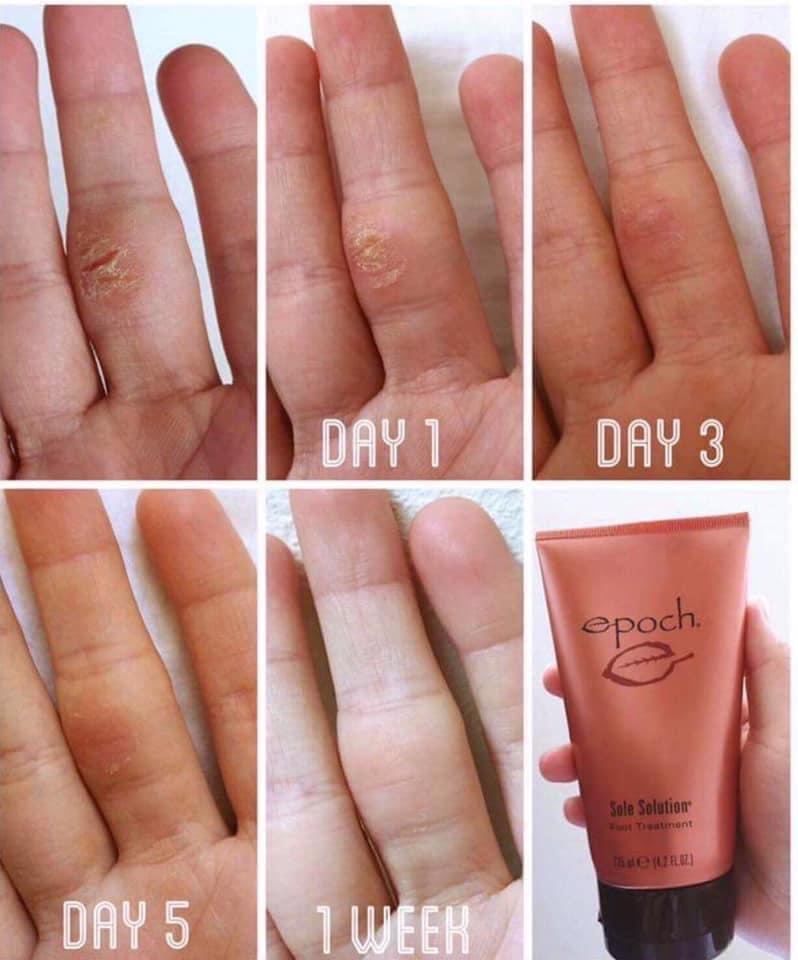 Kem Dưỡng Da Chân- EPOCH SOLE SOLUTION FOOT TREATMENT