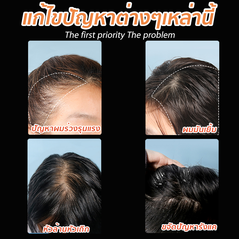 ZHENXIU 300ml แชมพูแก้ผมร่วง แชมพูขิง แชมพูสำหรับผมขาดหลุดร่วง ป้องกัน