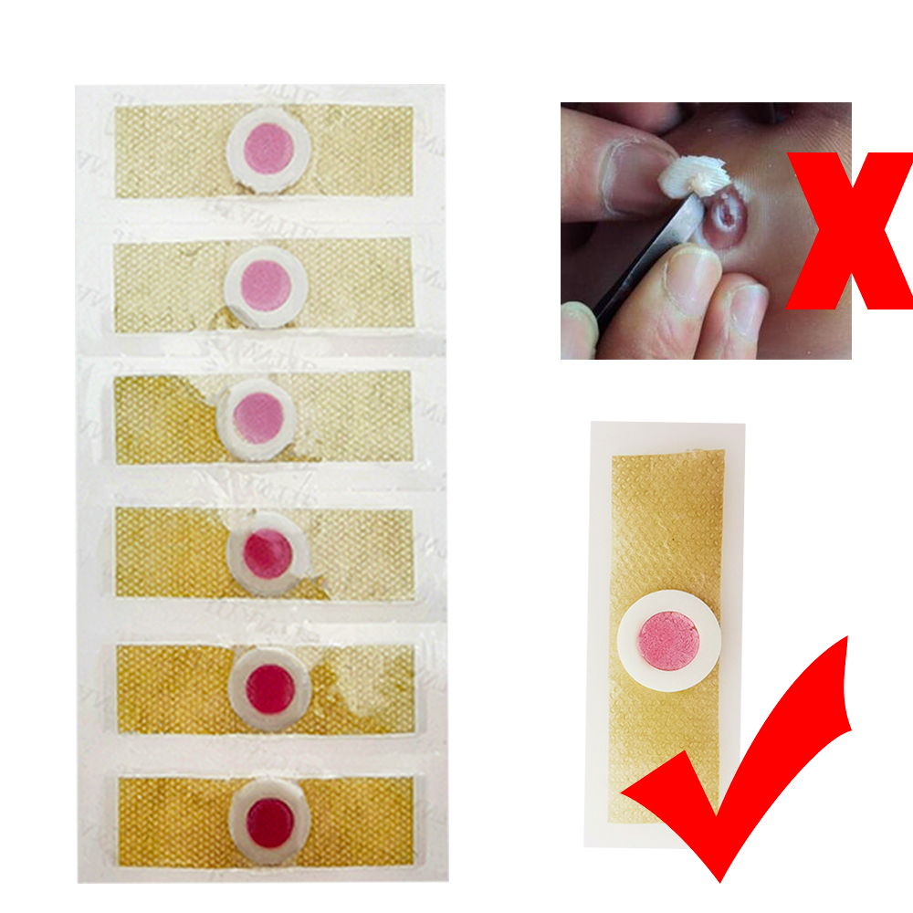 【TrendGlobe】12pcs Medical Plaster Foot Corn Removal Calluses Plantar ...