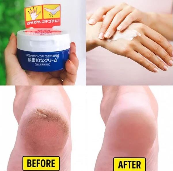 Kem nứt gót chân nhật bản, kem nẻ urea cream shiseido 100g làm mềm dưỡng da tay chân - 100g