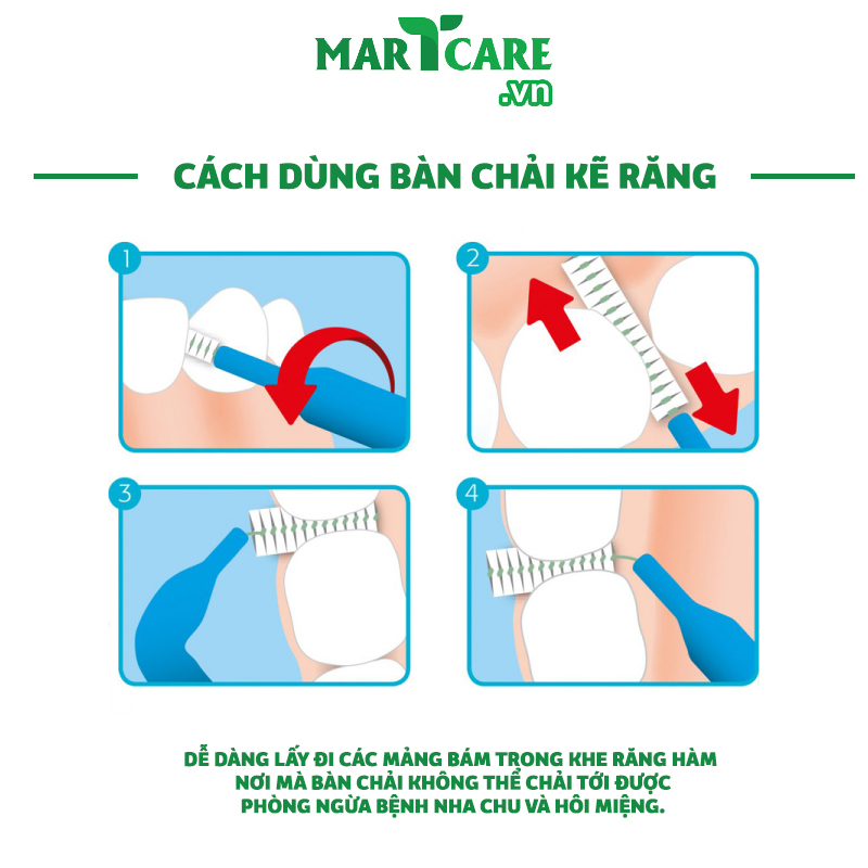 [GÓI 6C] Bàn Chải Kẽ Răng Dạng Chữ L Chính Hãng OKAMURA Asahi Nhật Bản Cho Răng Niềng Chỉnh Nha
