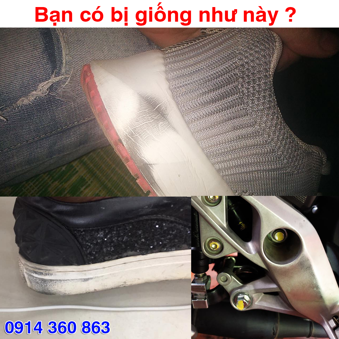 Che gác chân Winner X tránh đen giày