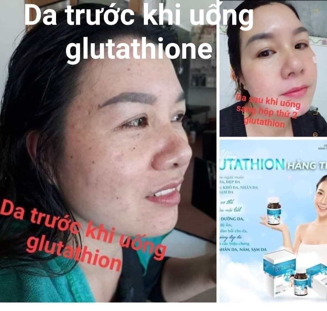 GLUTATHION HẰNG THU