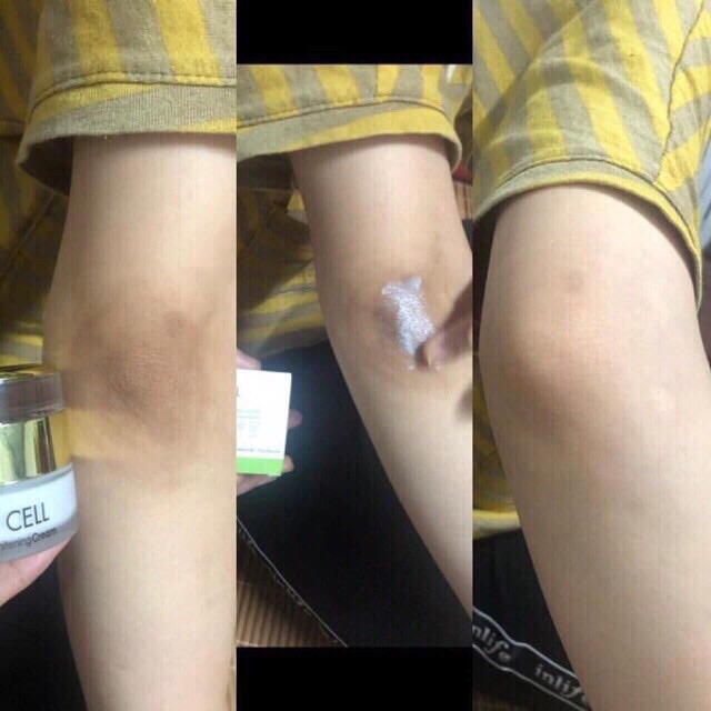 Kem Trị Thâm Nách Thâm Môi Thâm Đầu Gối OL-CELL