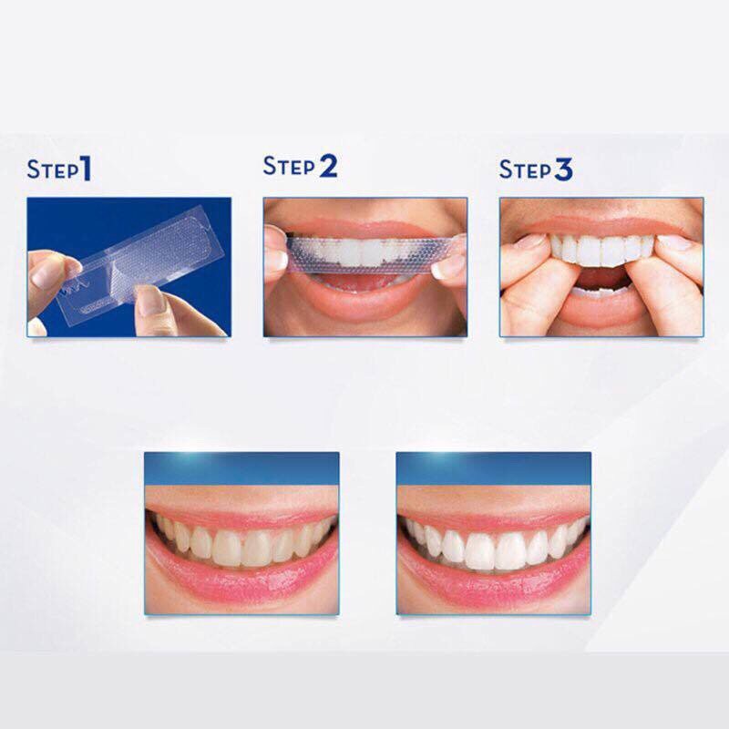 Miếng dán làm trắng răng 3d tiện dụng