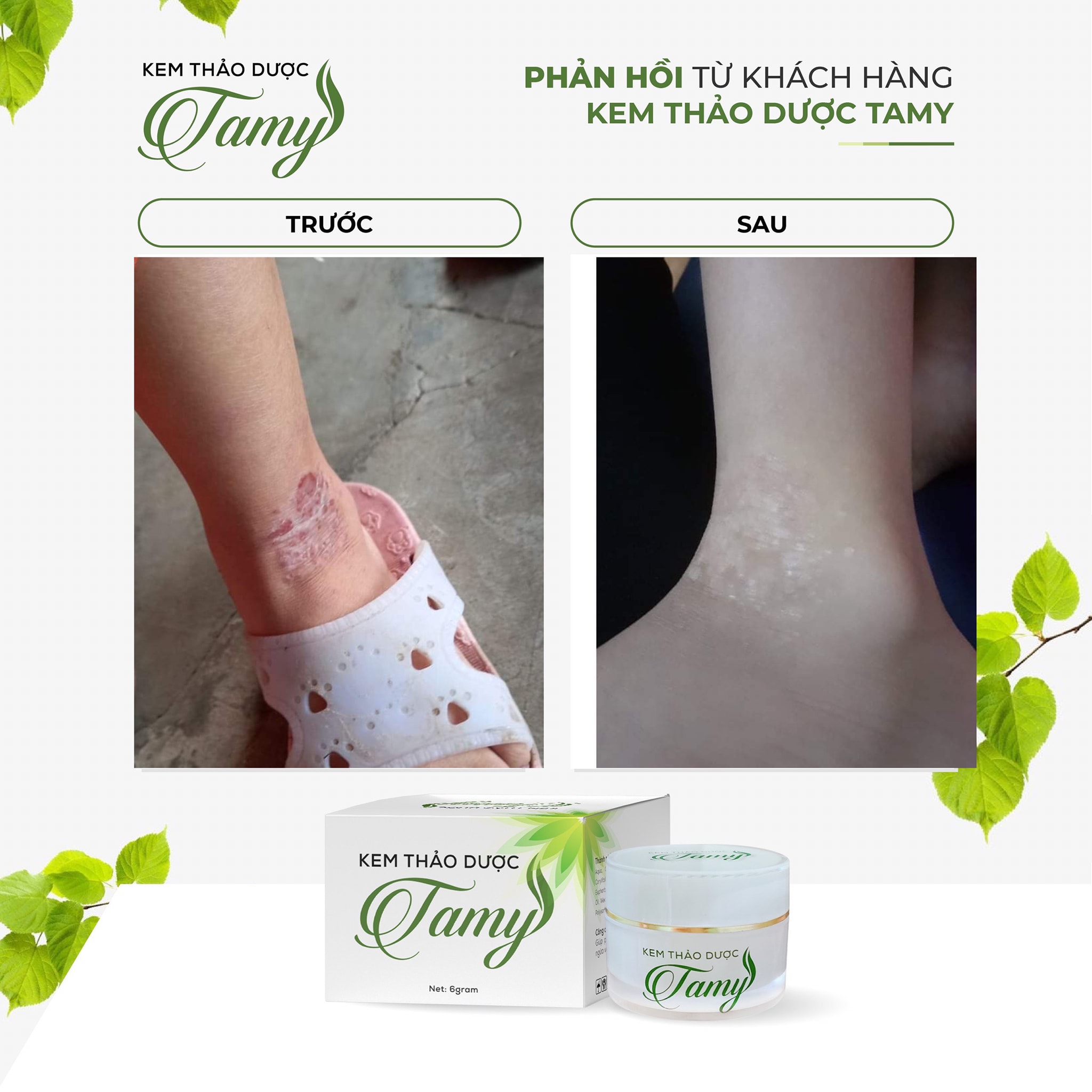 Tamy Herbal Cream