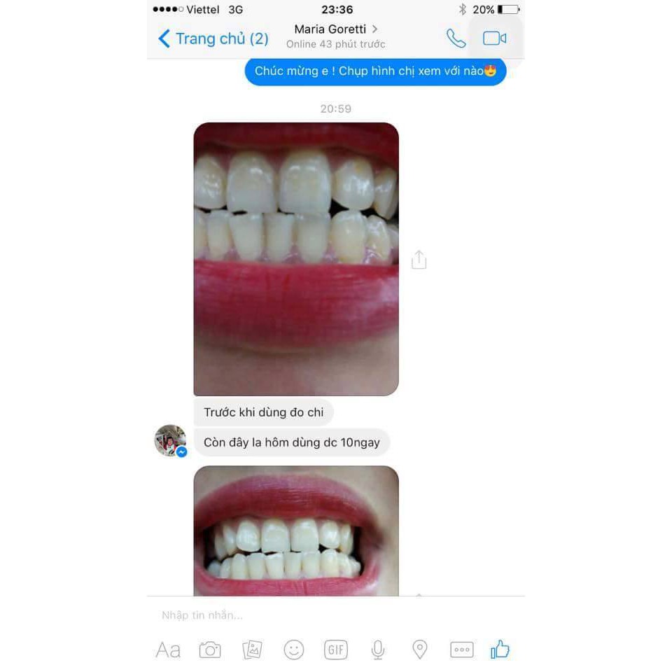 Kem đánh răng GLORY SMILE trắng răng than tre hoạt tính